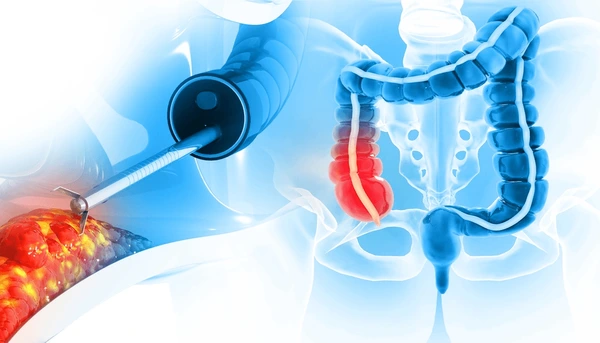 Colorectal Surgery